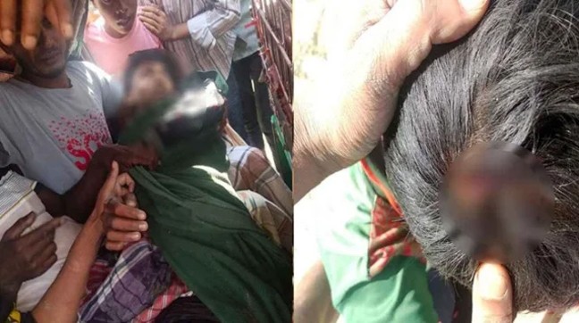 মিয়ানমার থেকে ছোড়া গুলিতে টেকনাফে ২ কিশোর আহত